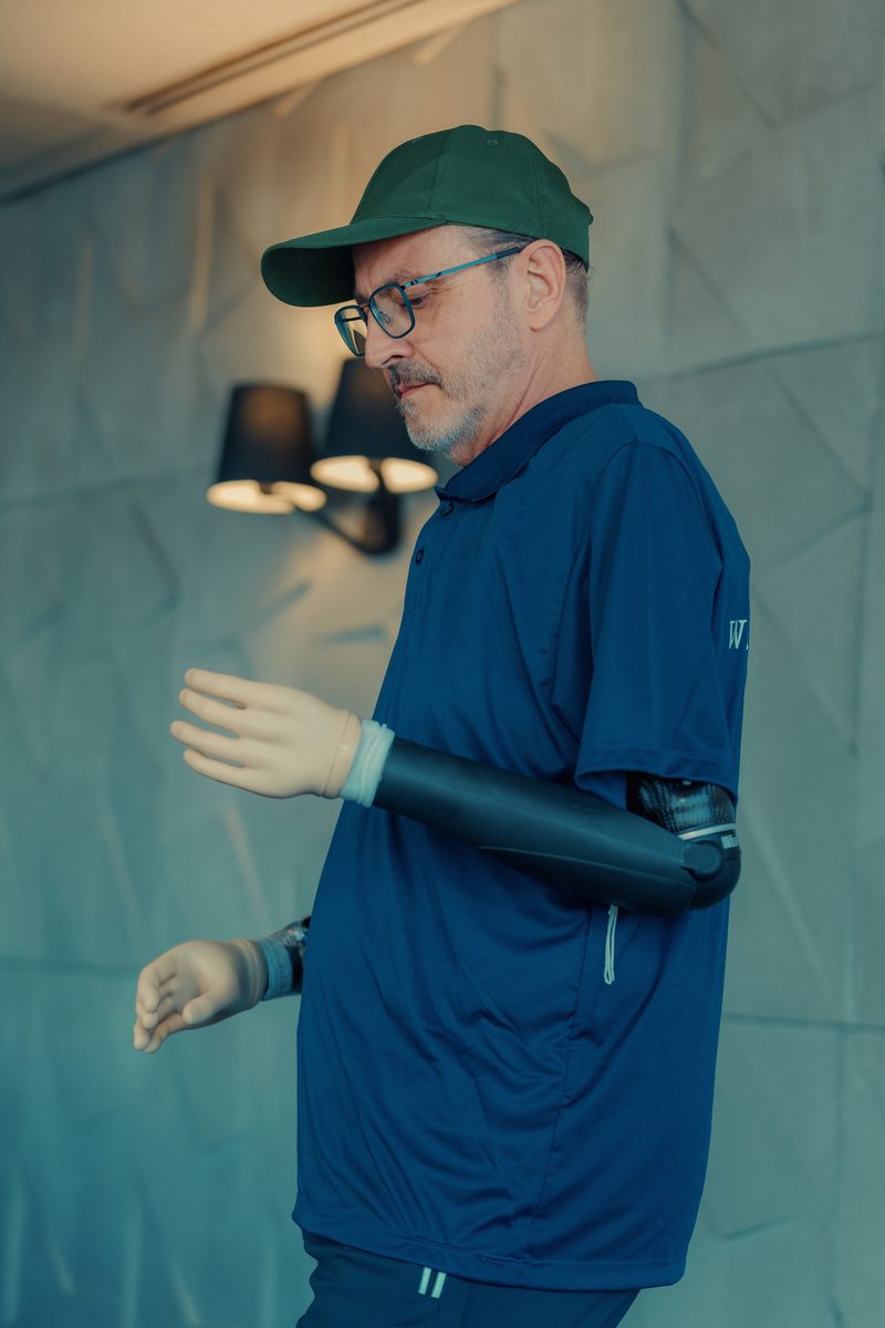 SpeedHand+Myosmart, prótese Mioelétrica Ottobock